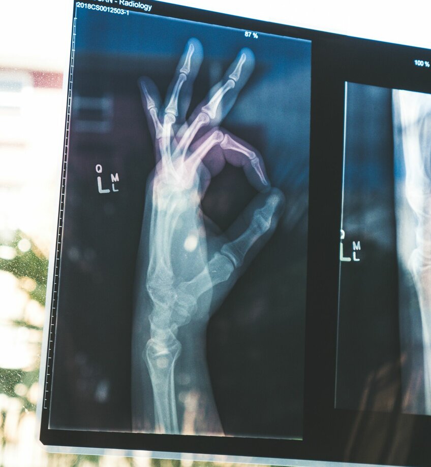 röntgen hand